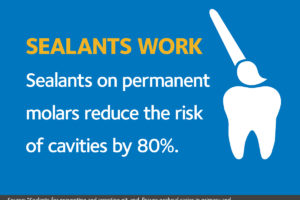 What about sealants?